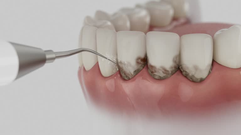 Trusted Wisdom Tooth Removal service in Tornado, WV - Dentist Open Now